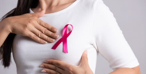 Cáncer de mama